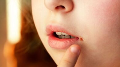 Experiencing Angular Cheilitis Warning Signs