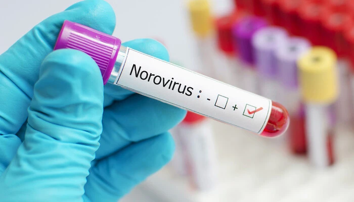 Norovirus Surge Expected in the UK, Health Officials Warn Public