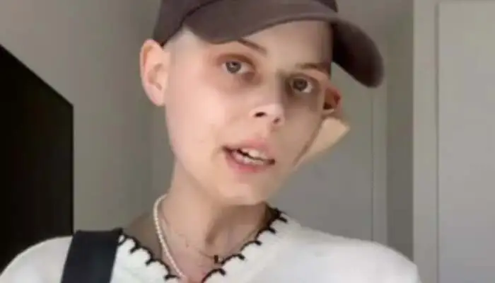 TikTok Star Bella Bradford Passes Away After Brave Cancer Battle