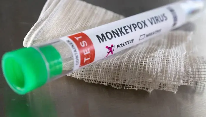 New Mpox Strain Reported in U.S. Traveler