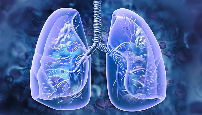 Repurposed Drug Shows Promise for KRAS-Mutated Lung Cancer