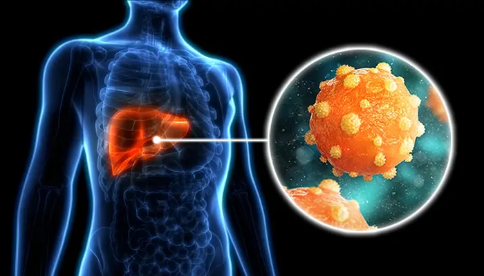 Conflict’s Hidden Toll The Fight Against Hepatitis