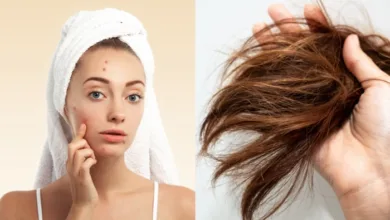 Winter Skincare and Haircare Effective Tips to Combat Dryness