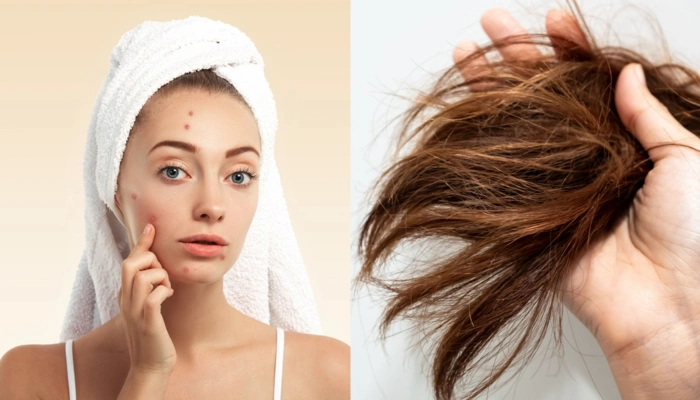 Winter Skincare and Haircare Effective Tips to Combat Dryness