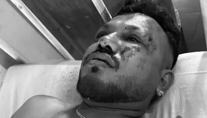 ‘Bodies All Around Me’ Survivor Recounts Horrific Air India Crash