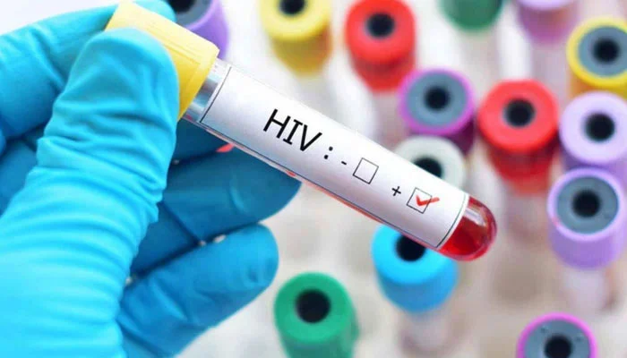 Pakistan's HIV Survey Sparks Controversy Over Data Manipulation