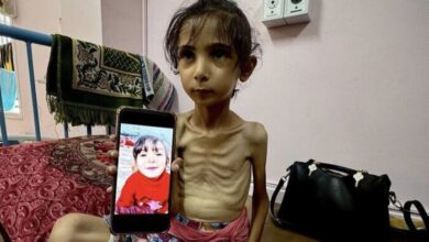 Gaza’s Smallest Victims Babies Face Starvation as Malnutrition Crisis Worsens