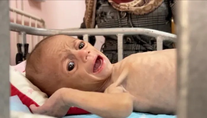 Israel Maintains Ban on Baby Milk Entry into Gaza