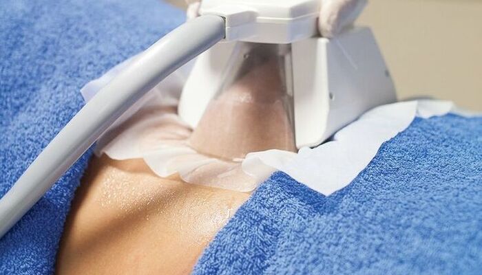 What Is Body Contouring Procedures, Risks, Recovery, and Costs